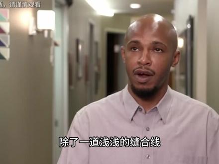 男子胸前大粉刺,竟挤出浓稠巧克力酱,挤压过程太解压了 #萌娃搞笑日常 #萌娃跳舞 #可爱萌娃 #上才艺 #这也太可爱了吧