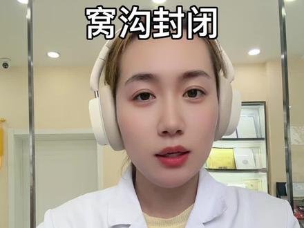 窝沟封闭操作流程 #创作者中心 #创作灵感 #口腔科普视频#口腔医师资格考试 #口腔日常工作 若有不对之处,欢迎多多指正。