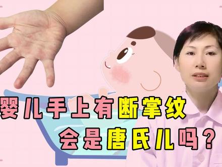 婴儿手上有断掌纹,会是智力低下吗?
