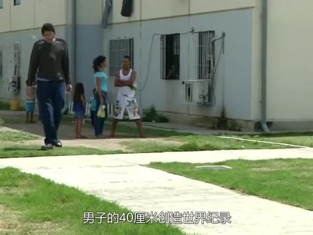 男子的“40厘米”创造世界纪录,生活不方便,家人也难以理解! #趣闻 #娱乐 #环境 #纪录 #巨大