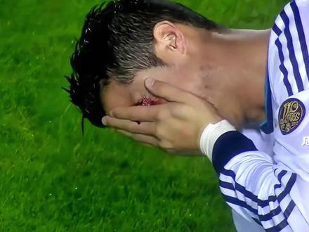 职业足球运动员的那些铁血瞬间 #dou来足球季 #足球的魅力