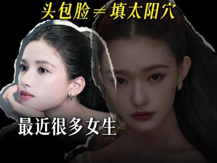 不要再盲目填充太阳穴了! #抖出健康知识宝藏#注射#医疗健康创作训练营#太阳穴凹陷 #面部抗衰