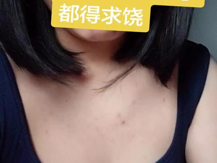 谁能想到拔个智齿会撕断舌神经呢! 到底你们为什么能干出这种事?出事后说是我的错??我相信你说的微创没危险,相信你说你技术好能拔,躺到那把命交给你搞三个小时,是我的错!!你做的手术是受害者的错!!!有天理没了?