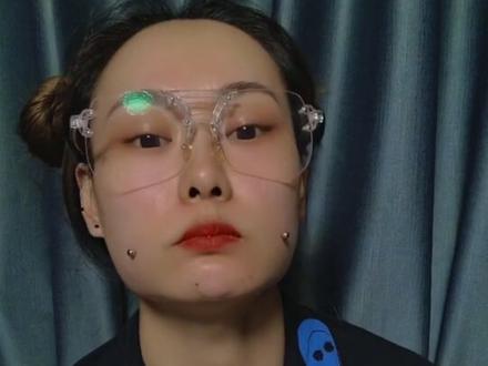 脸蛋子有些肿 一晚上基本没疼#酒窝钉#脸上打得是酒窝钉 #