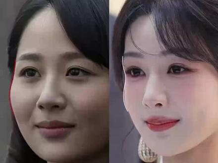 把外眼眶拉出来,就能视觉降颧骨…#林允 #杨紫 #外眼眶 #高颧骨 #面部设计