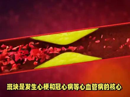 吃他汀多久,斑块能缩小 #抖出健康知识宝藏