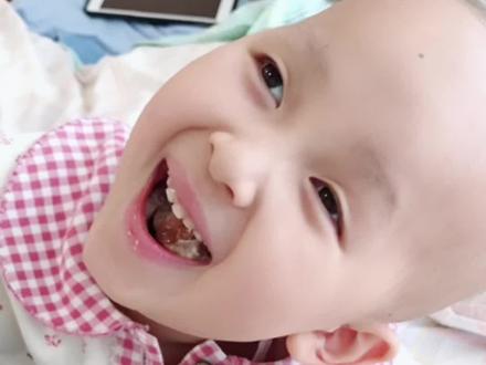 一转眼我女儿离开我1周年了,妈妈真的好想你...#关爱儿童健康 #警惕 #神经母细胞瘤