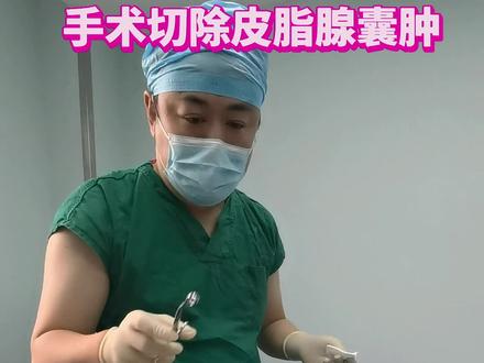 皮肤性病科医生赵大愚:粉瘤是什么?为什么会长粉瘤?#粉瘤 #皮脂腺囊肿 #粉瘤皮脂腺囊肿 #粉瘤切除 #皮脂腺囊肿切除
