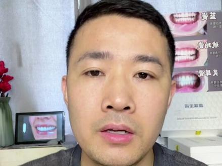 想要做牙贴片的宝子可以来看看 #美牙 #全瓷贴面 #变美