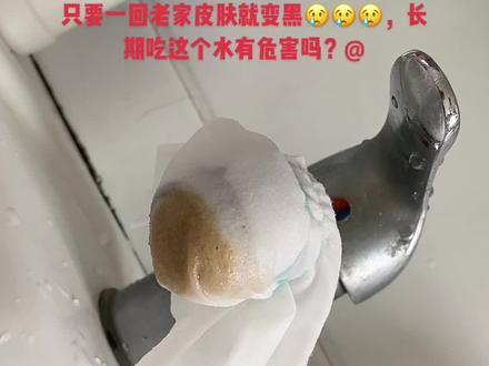 #惊不惊喜意不意外 只要一回农村不出门皮肤也变黑,终于找到原因了,原来是水黑,这才几分钟就黑了,过三天我再拍大家看会是什么样子?