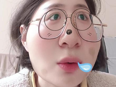 游书朗为何受伤这么重
#樊霄#游书朗#52