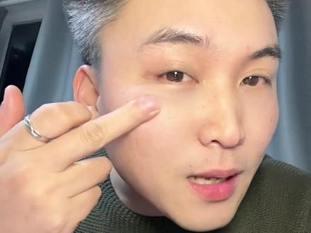 面部打薄,你又信了?#抗衰#轻薄#医美#避坑