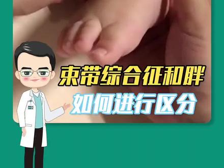 最近有家长带孩子来看束带,结果只是单纯的胖乎乎,那么束带综合征和宝宝肥胖如何区分呢?陈医生带你来分辨#关注儿童健康 #门诊故事