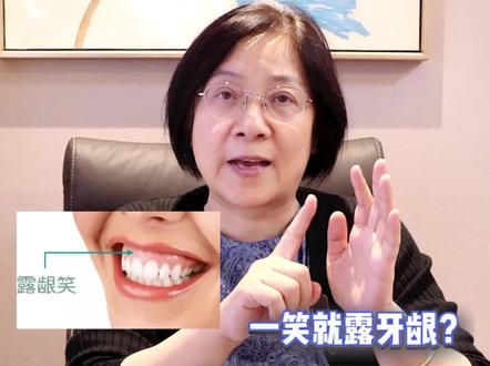 露龈笑不好看?有什么改善的办法? #露龈笑 #正畸 #整牙 #漏龈笑 #牙齿矫正