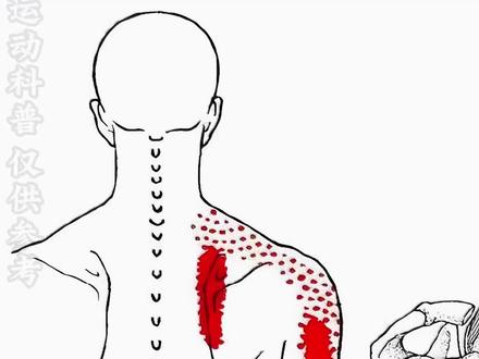 肩胛骨缝疼、手臂后侧还难受?两招轻松解决 是不是肩胛骨缝老是酸酸的,还会牵扯到手臂后侧?
大家都以为是肩颈劳损,其实很可能是斜角肌和胸小肌紧张导致的!
✅ 为什么会不舒服?
长期低头、含胸、姿势不良,会让斜角肌和胸小肌变得紧张,
它们会压迫经过的神经和血管,导致肩胛骨缝和手臂后侧酸痛、僵硬。
🎯 今天教你2个动作,快速放松肩胛骨缝和手臂!
#内容启发搜索 #手臂发麻 #健身小技巧 #简单放松动作 #抖音开跑计划
✅ 动作1:斜角肌放松
1️⃣ 找到锁骨中间上方一指的位置。
2️⃣ 用手指轻轻按压住,然后头左右缓慢转动,重复20次。
✅ 动作2:胸小肌松解
1️⃣ 用一只手从腋窝下方扣住对侧胸前肌肉。
2️⃣ 痛侧手臂做绕圈20次,感受肌肉的松解。
📌 这两个动作做3组,做完后肩胛骨缝和手臂后侧会瞬间轻松!✨
🎯 为什么有效?
✅ 放松斜角肌,减少对神经的压迫
✅ 缓解肩胛骨缝酸痛,改善手臂僵硬感
✅ 提升上半身灵活度,改善含胸体态
📌 别犹豫了!快坐起来试试吧!做完记得告诉我你的感受~更多体态矫正技巧,记得关注我哦!😉
