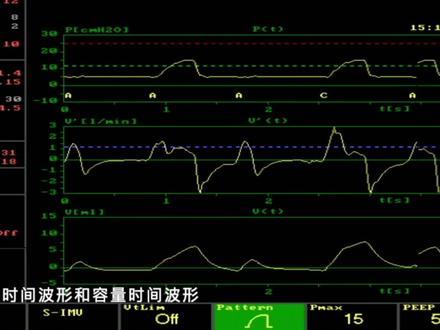 呼吸机模式和波形怎么看看完这个视频你就知道啦#医学科普 #智能制造 #脑卒中 #医学动画 #疫情下的天选打工人