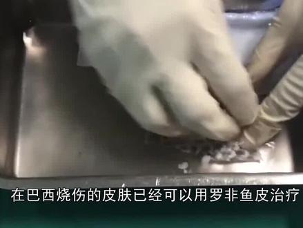 罗非鱼皮还能治烧伤?在中国泛滥的罗非鱼,终于有了出头之日?