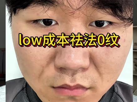 关于法令纹,说说我的个人经验,详细版教程#真实生活分享计划#法令纹#淡纹护理#抗衰#护肤