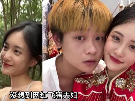 网红飞猪夫妇恋爱前后颜值差距居然这么大,现实版的美女与野兽,背后究竟有何故事 #网红 #飞猪夫妇 #情侣