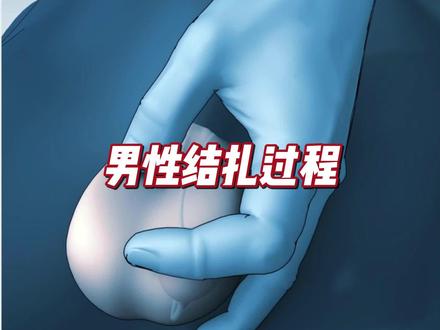 3D还原男性结扎全过程,女生划走 #结扎 #结扎复通 #3d动画演示 #科普 #涨知识