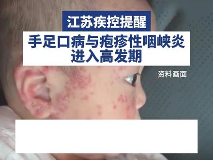 甲流?手足口?这个冬天病毒有点猛,药箱备好两种药! #甲流 #手足口 #医学科普