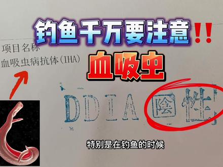 钓鱼人户外野钓一定要注意血吸虫,这个季节很多!#钓鱼知识 #路亚教学 #路亚新手入门教程 #血吸虫 #钓鱼