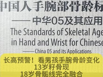 长高预警!孩子骨龄片怎么看#身高管理 #骨龄偏大#长个