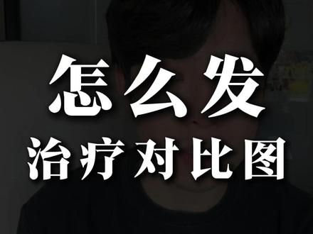 分享3个案例发布的实用小技巧, 把“治好”变成“记录”,既合规又能让客户看懂#美业 #皮肤管理店 #线上获客 #问题肌