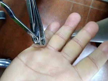 #康复训练 #手功能康复 剪茧子@抖音小助手