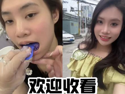 花一分钟 了解我在海口做牙贴面全过程吧~ #牙齿美白逆袭攻略 #逆袭冷白皮牙齿