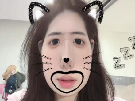 do👃后五天真实感受反馈及小白必看要点笔记 闺蜜们我终于剪出来了 久等了 不喜勿喷哈 仅代表个人观点#肋骨鼻 #全麻手术 #真实感受分享 #武汉鼻子 #肋骨鼻功课