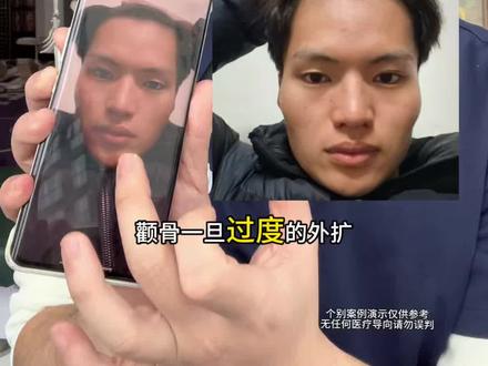 颧骨外扩 针对性改善动作 1.适合后天生活习惯所导致的面部问题
2.训练过程中 保持身心平静 感受深层肌肉的发力 配合呼吸会事半功倍
3.个别案例演示仅供参考
#体态纠正 #颧骨内推 #脸型 #青年创作者成长计划