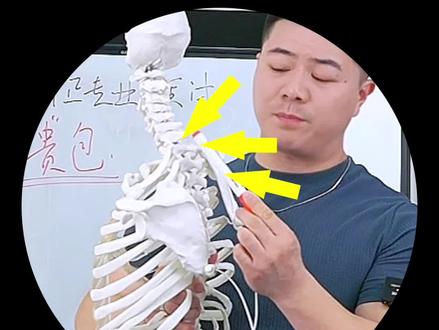 【教练/形体老师提升】 富贵包/颈后大包的深度拆解以及多角度解析#体态矫正 #cpal形体矫正技术培训