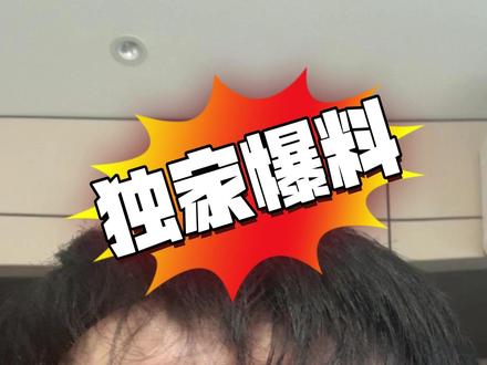 我错了,别跌了。 #交易实验室 #黄金大跌