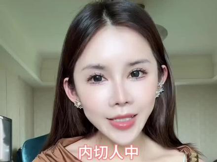 内切人中到底怎么做的,效果怎么样,能不能做?真实案例告诉你#内切人中 #人中缩短 #变美