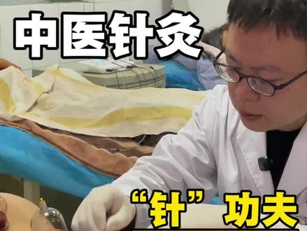 中医针灸,痤疮痘痘,针刺放血疗法 #中医针灸#中医埋线#埋线减肥#医生日常#洛阳孙大夫