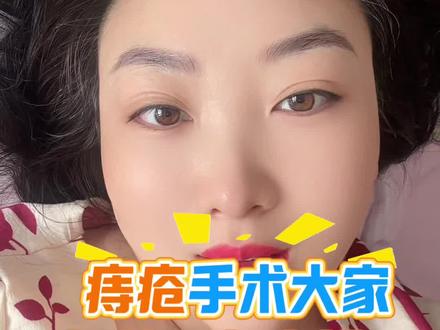 给大家解答一下痔疮手术的问题 关于费用,手术过程,手术原因以及术后排便的问题,大家根据自己情况看看哦#肛肠科#哈尔滨中医院 #痔疮手术#混合型痔疮