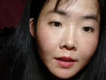 吃了山楂 红薯 柿子胃疼 胃酸#可乐