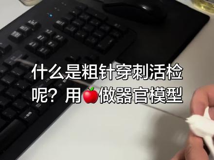 穿刺活检是怎么操作的呢?一般穿刺活检是在超声影像的实时引导下,分为粗针活检和细针活检,#甲状腺穿刺 一般首选细针如普通注射器。有时需要取多的组织细胞,就要用到粗针,如视频所示的活检枪又叫活检针。#美食小技巧 #生活小技巧学会你就捡到宝了 #生活小实验 #医学科普