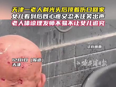天津一老人剃光头后顶着伤口回家,女儿看到后既心疼又忍不住笑出声,老人体谅理发师不易不让女儿追究。#天津 #理发