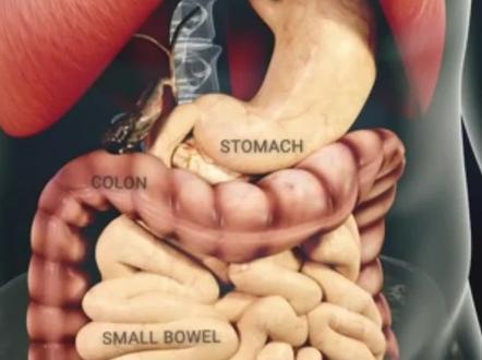 食物从吃进去到拉出来一共需要多少时间,经历哪些消化过程?#消化