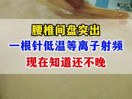 腰椎间盘突出,一根针低温等离子射频 #射频消融术#医学科普#腰疼#腰突微创