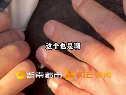 #10个月宝宝出生浑身黑皮确诊兽皮痣
乐宝妈妈哭诉:大儿子六岁出车祸走了
现在二儿子又基因突变身体长满巨痣#巨痣宝宝 #河南商丘 @乐宝加油