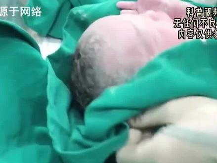 婴儿在出生的时候,为啥都是哭着的?看完终于明白哭的重要性了(1)?#科普 #涨知识 #生活 #孩子 #揭秘