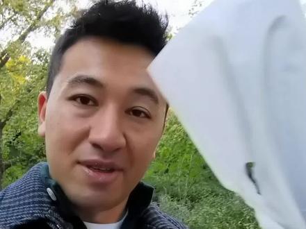 今天做了很多检查,医生说我应该不会变笨😅 #反转