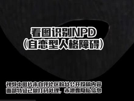 显性NPD和隐性NPD虽同属自恋型人格特质,核心都是过度自我中心与缺乏共情,但外在表现差异显著,容易让人产生“完全不同”的错觉:
1. 自我展示的方式:外放 vs 内敛
• 显性NPD:像“孔雀开屏”,主动炫耀自身优势——会直白地吹嘘成就、地位、财富,甚至夸大经历(比如“我当年搞定的项目比这大十倍”),渴望成为人群焦点,对“不如自己”的人常表现出轻蔑(如打断他人、否定对方价值)。
• 隐性NPD:像“蚌壳藏珠”,不直接炫耀,而是通过“反向表达”凸显自己的“特殊”——比如用“唉,能力太强也麻烦,总被人依赖”“我其实不在乎名利,只是他们非要给我”这种看似低调的话,暗示自己的优秀;或通过“扮演受害者”博取关注(如“没人懂我有多难”),变相强调自己的“独特性”。
2. 对批评的反应:暴怒 vs 冷战/自贬
• 显性NPD:被质疑时像“炸毛的狮子”,会立刻激烈反驳,甚至攻击批评者(如“你懂什么?”“嫉妒就直说”),用愤怒掩盖被否定的羞耻感,绝不承认自己有错。
• 隐性NPD:被批评时像“缩回壳的蜗牛”,表面不争吵,却用冷战、沉默、自我贬低(如“我果然什么都做不好,让你失望了”)来操控对方——让你产生“是不是我太苛刻”的愧疚感,最终反过来安抚他,间接维护了他“不可被指责”的自我认知。
3. 人际关系模式:掌控 vs 依赖(伪装)
• 显性NPD:在关系中像“国王”,习惯用命令、贬低控制他人(如“这事必须按我说的做”“你这点小事都办不好”),把对方当“侍从”,满足自己的优越感。
• 隐性NPD:在关系中像“需要被拯救的公主”,表面依赖他人(如“没有你我可怎么办”),实则通过“示弱”让对方持续付出,同时暗中挑剔(如“你这点关心根本不够”),用“被辜负”的姿态维持“自己值得更好对待”的幻觉。
4. 核心动机的暴露:直接 vs 隐晦
两者的核心都是“需要被特殊对待”,但显性NPD的需求直接可见,而隐性NPD的需求藏在“脆弱”“低调”的外衣下,更难被察觉——比如同样渴望被赞美,显性NPD会说“你得承认我做得很好”,隐性NPD则会说“其实我没你想的那么好(但你必须反驳我,说我很好)”。
无论是显性还是隐性,本质都是用不同方式维系“自我优越”的幻象,都会给身边人带来情感消耗。
#npd #隐性npd #自恋型人格障碍 #婚姻家庭 #看图识人