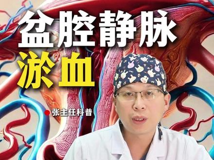 非经期下腹部隐痛可能是盆腔静脉淤血的隐藏信号 #河南省妇幼保健院 #张凯医生 #医疗健康创作训练营 #盆腔静脉淤血 #抖出健康知识宝藏
