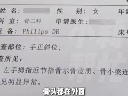 4月16日(发布),商丘夏邑,4岁女童参加幼儿园拔河比赛,手指竟被“拔”断一截!家人痛心:大人都不能承受这种痛苦,幼儿园园长:很抱歉,不会推脱责任。#媒体精选计划 #河南dou知道 #不一样的中国节气 #中国节气小满篇