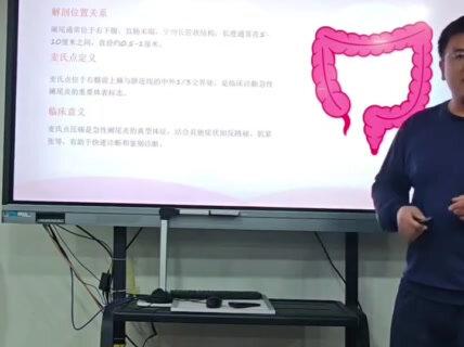 阑尾的解剖位置 #阑尾 #医学科普 #阑尾炎