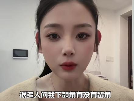 下颌角是留角还是不留角 到底怎么选择?#下颌角 #真实记录